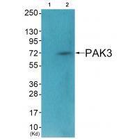 Rabbit Polyclonal Antibody to PAK3 (Ab-154)