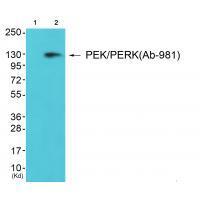 Rabbit Polyclonal Antibody to PEK/PERK (Ab-981)