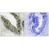 Rabbit Polyclonal Antibody to PEK/PERK (Ab-981)
