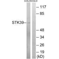 STK39 (Ab-325)