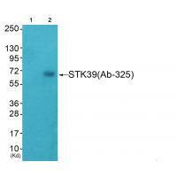 Rabbit Polyclonal Antibody to STK39 (Ab-325)