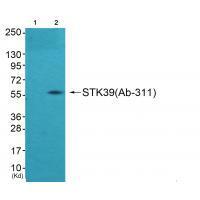 Rabbit Polyclonal Antibody to STK39 (Ab-311)