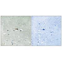 Rabbit Polyclonal Antibody to TTK (Ab-676)