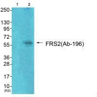 Rabbit Polyclonal Antibody to FRS2 (Ab-196)
