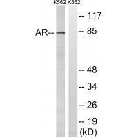 Androgen Receptor (Ab-363)