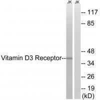 Vitamin D3 Receptor (Ab-51)