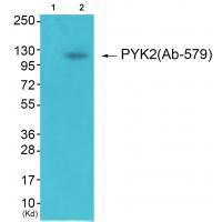 Rabbit Polyclonal Antibody to PYK2 (Ab-579)