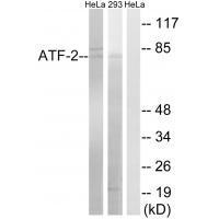 ATF-2 (Ab-472)