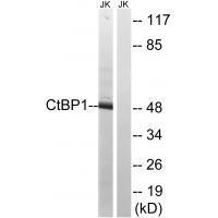 CtBP1 (Ab-422)