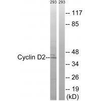 Cyclin D2 (Ab-280)