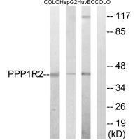 PPP1R2 (Ab-44)