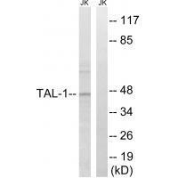 TAL-1 (Ab-122)