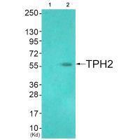 TPH2 (Ab-19)