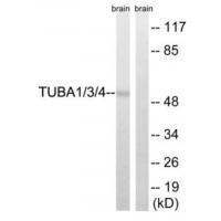 TUBA1/3/4 (Ab-272)