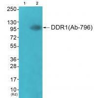DDR1 (Ab-796)