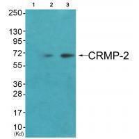 Rabbit Polyclonal Antibody to CRMP-2 (Ab-522)