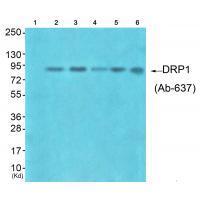 DRP1 (Ab-637)