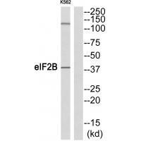 eIF2B (Ab-67)