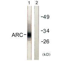 ARC