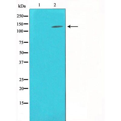 Collagen III