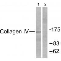 Collagen IV