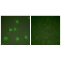 Rabbit Polyclonal Antibody to Cullin 1
