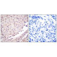 Rabbit Polyclonal Antibody to Cullin 1