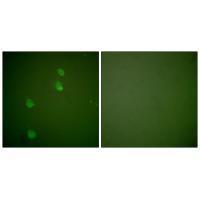Rabbit Polyclonal Antibody to Cullin 2