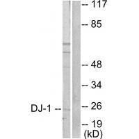 DJ-1