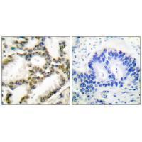 Rabbit Polyclonal Antibody to DJ-1