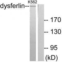 Dysferlin