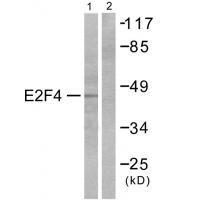 E2F4