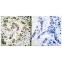 Rabbit Polyclonal Antibody to E2F4