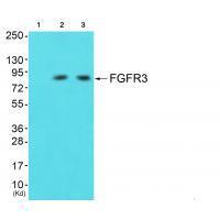 Rabbit Polyclonal Antibody to FGFR3