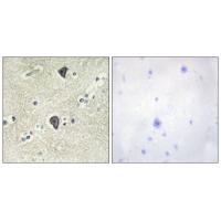 Rabbit Polyclonal Antibody to FGFR3