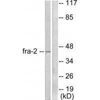 Fra-2