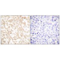 Rabbit Polyclonal Antibody to Fra-2