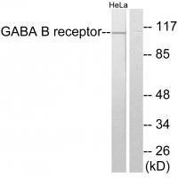 GABA B Receptor