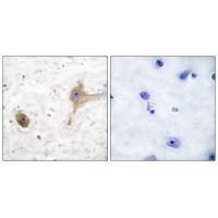 Rabbit Polyclonal Antibody to GABA B Receptor