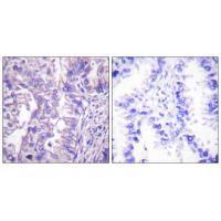 Rabbit Polyclonal Antibody to GAD1/2