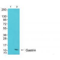 Rabbit Polyclonal Antibody to Gastrin