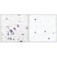 Rabbit Polyclonal Antibody to GluR2/3