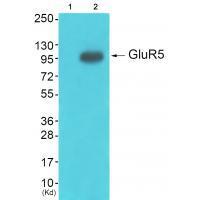 Rabbit Polyclonal Antibody to GluR5