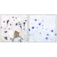 Rabbit Polyclonal Antibody to GluR5