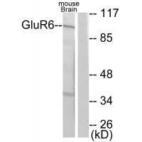 GluR6