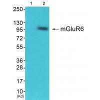 Rabbit Polyclonal Antibody to GluR6