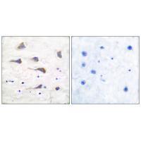 Rabbit Polyclonal Antibody to GluR6