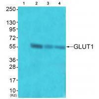 Rabbit Polyclonal Antibody to GLUT1