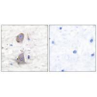 Rabbit Polyclonal Antibody to GLUT1