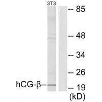 hCG β